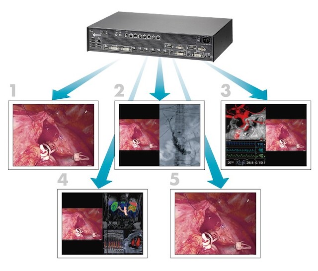 LMM0804 - Different Layouts on Multiple Monitors