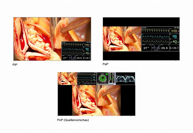 Monitor - LX49xW - PiP