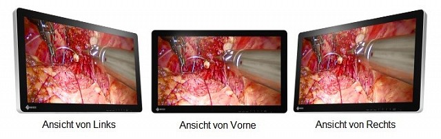 Monitor - Endo 3D - Viewing Angle 26"