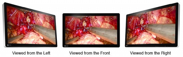 Monitor - Endo 3D - Viewing Angle 32"