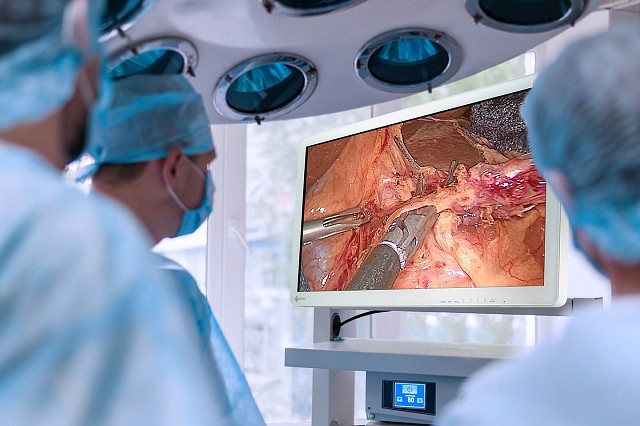 Monitor - Endo 2D - HD 32"