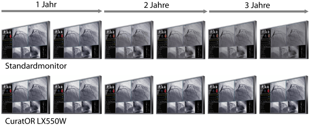 Monitor - LX550W - Konsistenz durch Kalibrierung gemäß DICOM Part 14