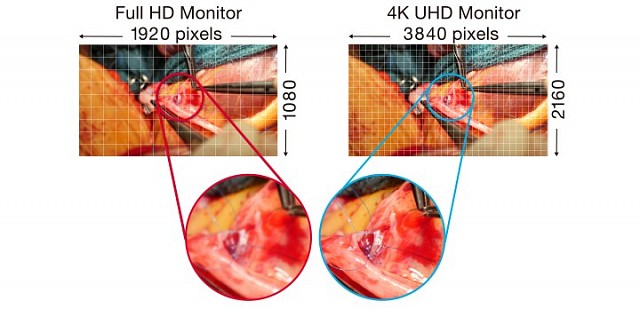 Monitor - Endo 4K - UHD Display