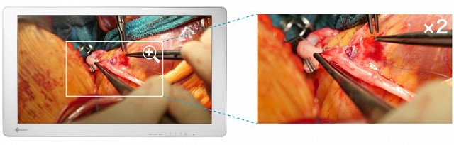 Monitor - Endo 4K - Zoom