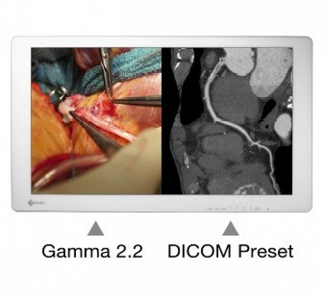 Monitor - Endo 4K - Adjust Screens