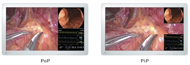 Monitor - Endo 2D - PoP EX2621