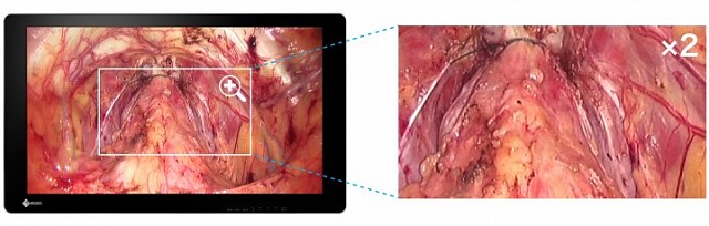 Monitor - Endo 4K 3D - Large Images EX3141-3D