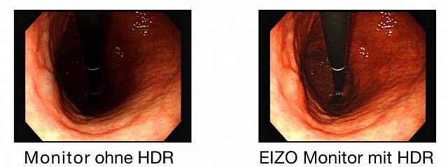 Monitor - Endo 3D 4K - HDR EX3141-3D
