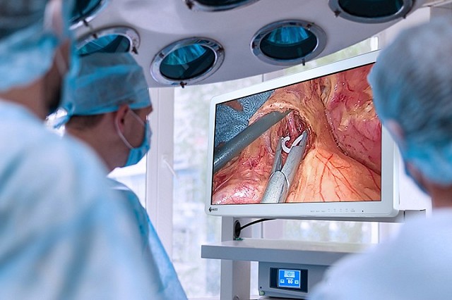 Monitor - Endo 2D - EX2721