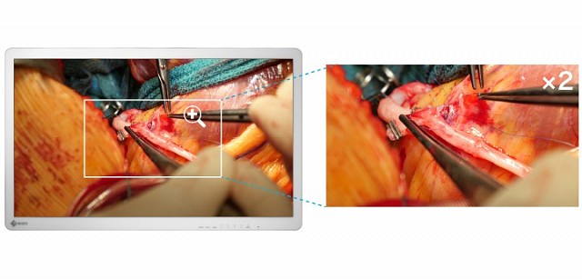 Monitor - Endo 4K - Large Images EX3241