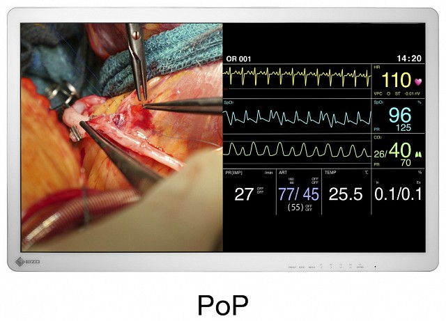 Monitor - Endo 4K - Multiple Signals EX3241