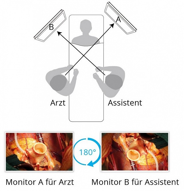 Monitor - Endo 4K - Drehung & Spiegelung EX4342