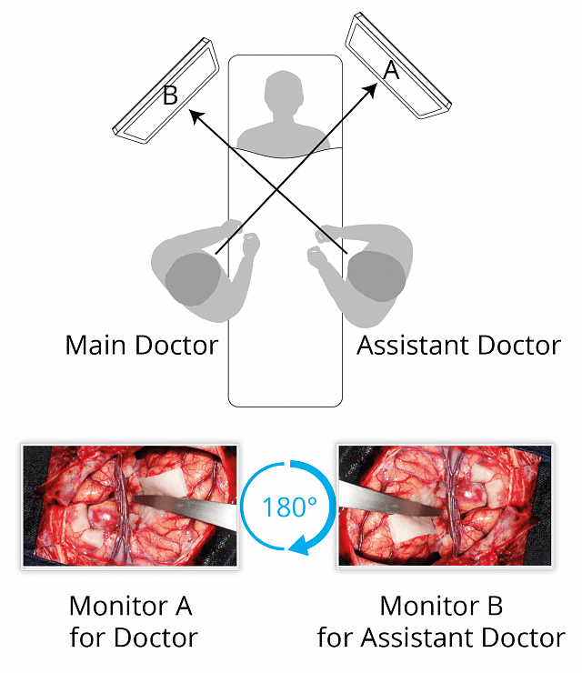 Monitor - Endo 4K - Rotate and Mirror EX5542