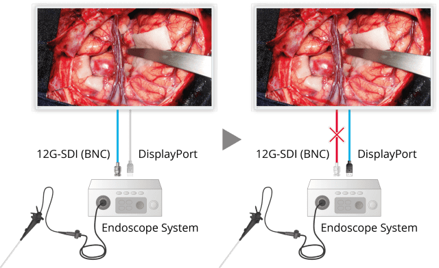 Monitor - Endo 4K - Fail-Safe Display EX5542