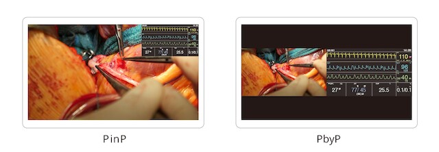 Monitor - Endo 4K - Multiple Signals