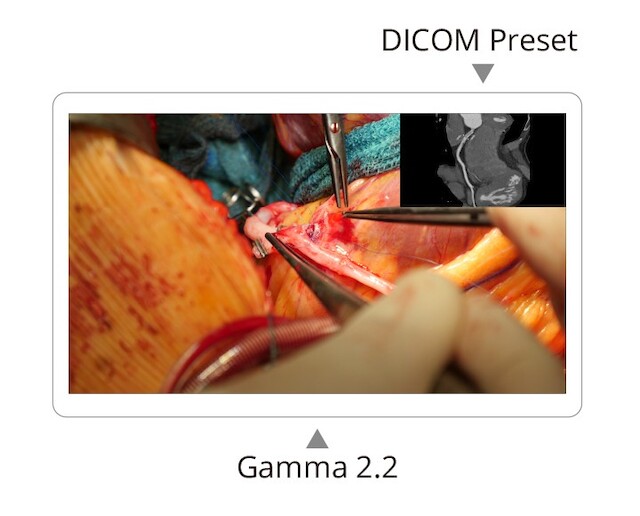 Monitor - Endo 4K - Adjust Independent