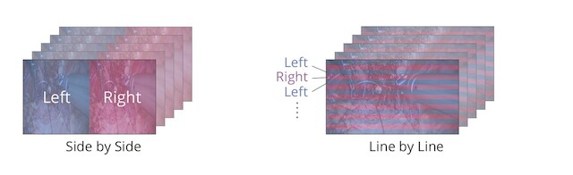 Monitor - Endo 3D - 3D-Formats EX4342-3D
