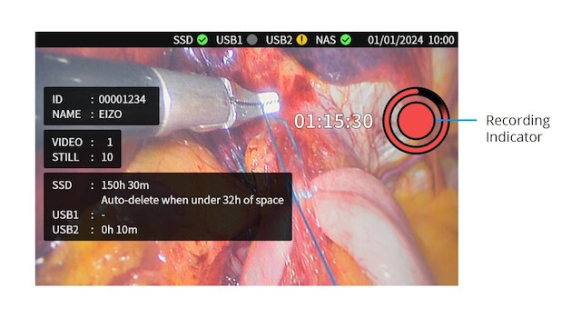 Recorder - Confirm Status