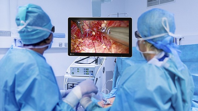 Monitor - Endo 3D - Visibility 32" FHD