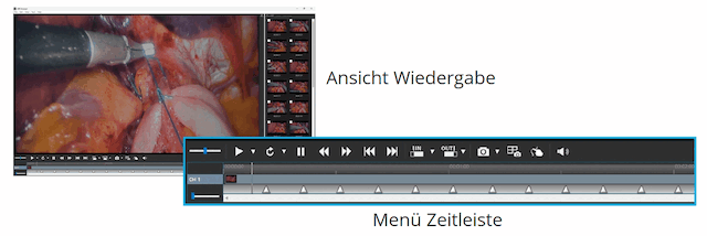 MIR Browser - Editing and Clipping
