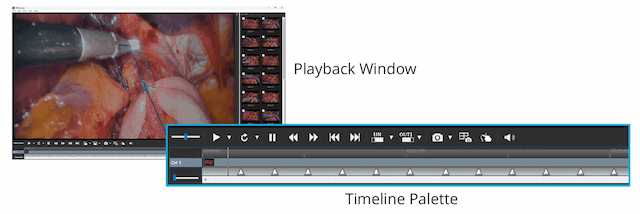 MIR Browser - Editing and Clipping