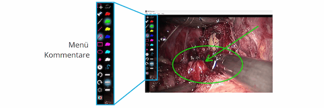 MIR Browser - Annotations