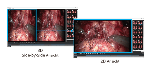 MIR Browser - Referencing